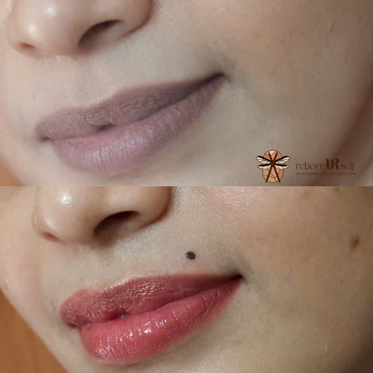 Beauty spot placed beside the lips, before and after