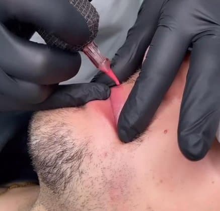 Lip Blushing for Men procedure at Rebornurself