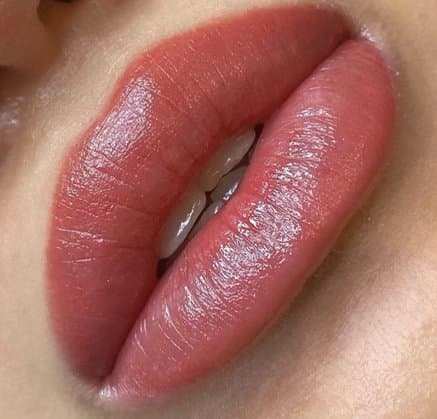 Lip Neutralization for Women procedure at Rebornurself