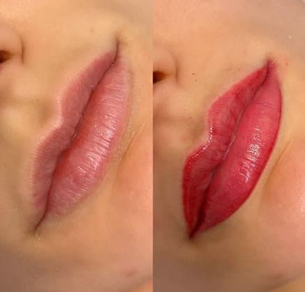 Lip Blushing for Women procedure at Rebornurself