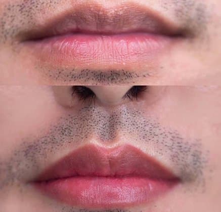 Lip Blushing for Men result at Rebornurself