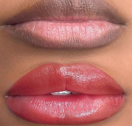 Lip Neutralization for Women result at Rebornurself