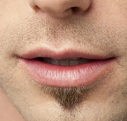Lip Neutralization for Men result at Rebornurself