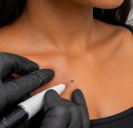 Beauty spot placed on the collarbone